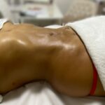 drenagem linfatica 1